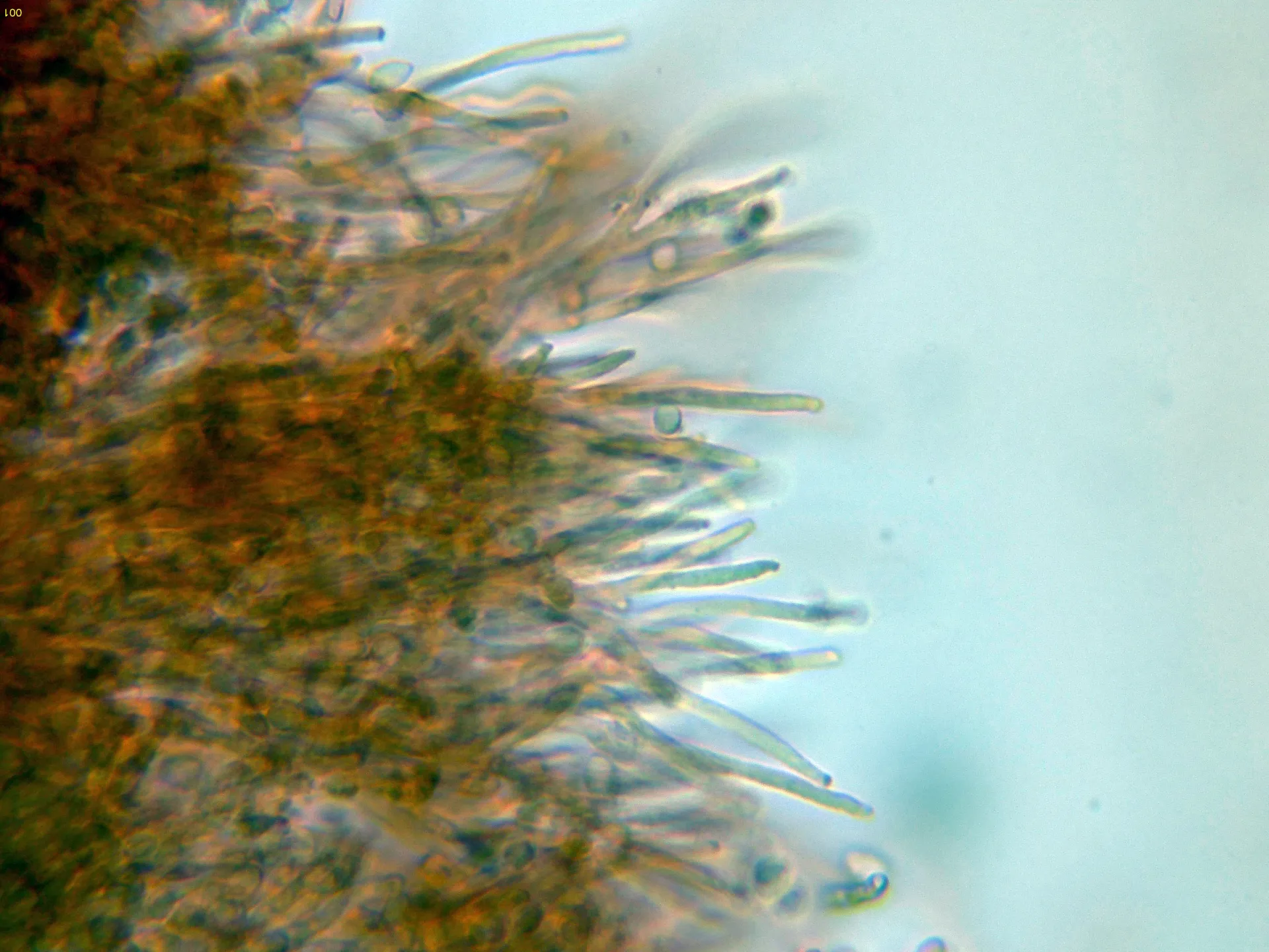 Microscopía de Nodulisporium umbrinum - 10 - Hifas conidiógenas-001